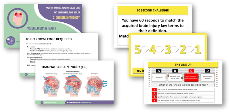 Hsc Interactive C1.7 Acquired Brain Injury Topic PowerPoints and Interactive Games ...