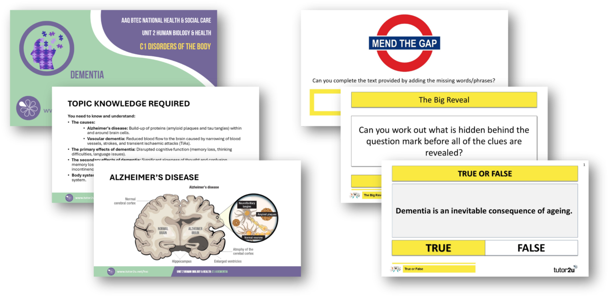 C1.6 Dementia Topic PowerPoints and Interactive Games | Unit 2 Human ...
