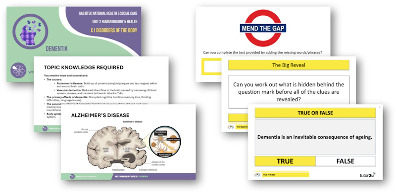 Hsc Interactive C1.6 Dementia Topic PowerPoints and Interactive Games | Unit 2 Human ...