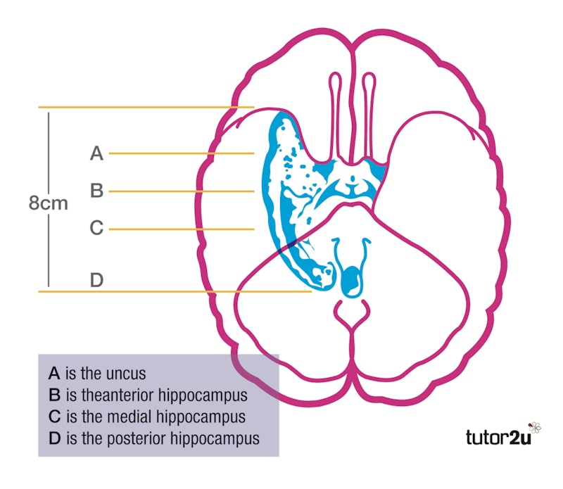 Scoville and Milner (1957) | Reference Library | Psychology | tutor2u